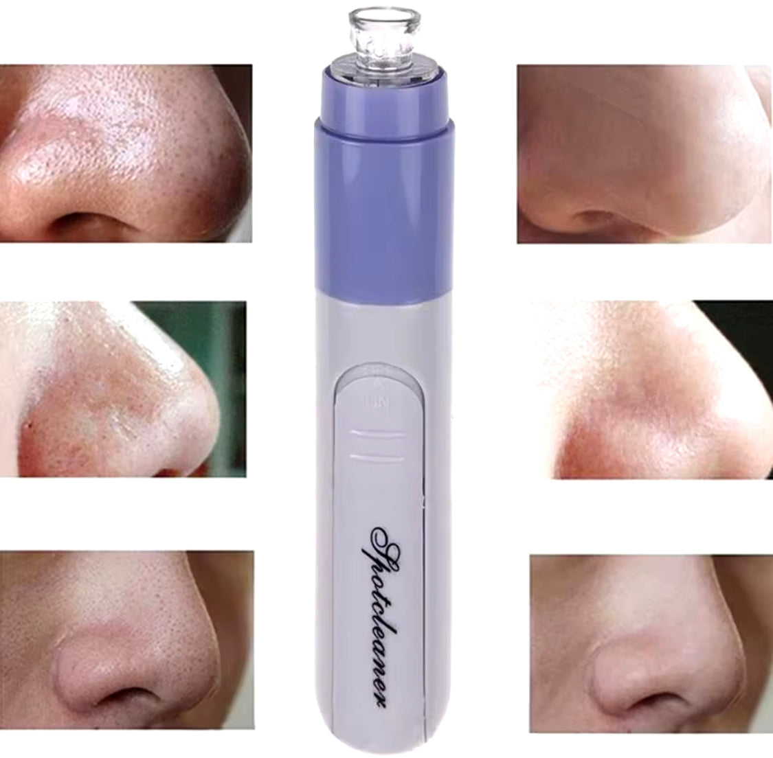 Cell Operated Pore Cleaner, Acne Tool Blackhead Remover, Nose Cleansing Beauty Instrument Cell Operated Pore Cleaner, Acne Tool Blackhead Remover, Nose Cleansing Beauty Instrument